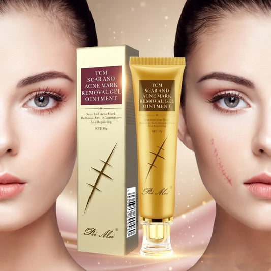 Youthful Scar Remover Cream 2.0 – Natural Scar Treatment 30ml