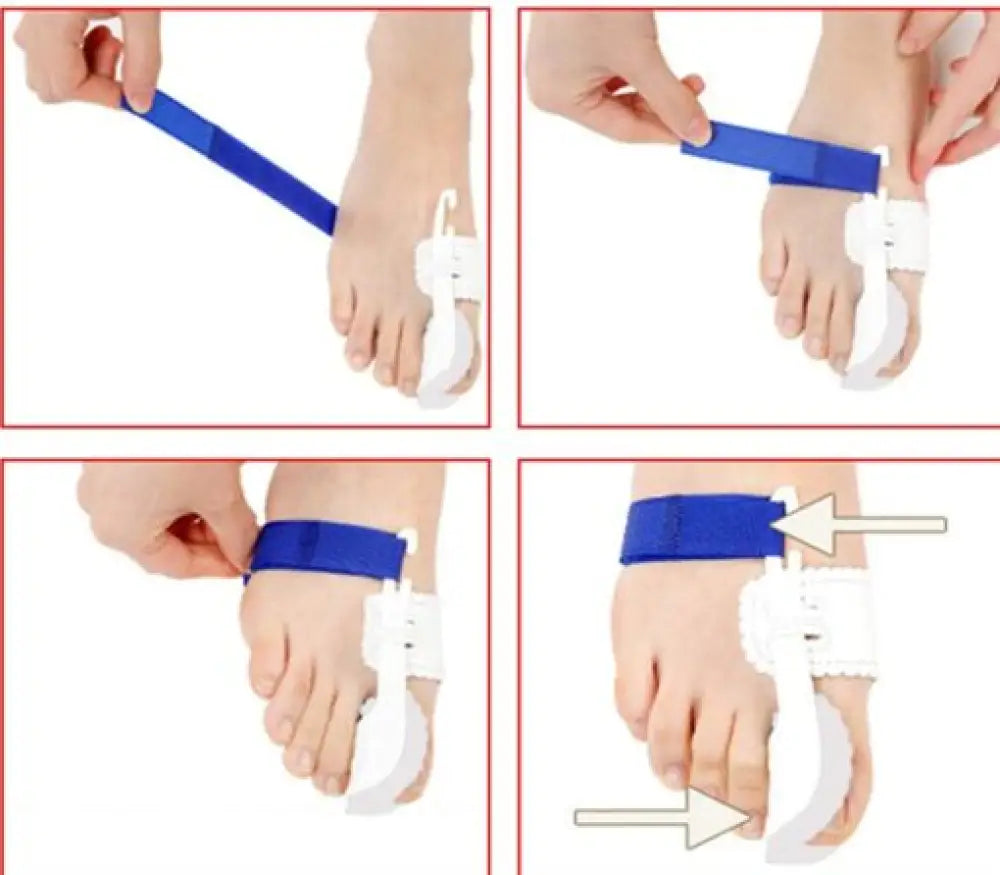 Toe Correction Brace