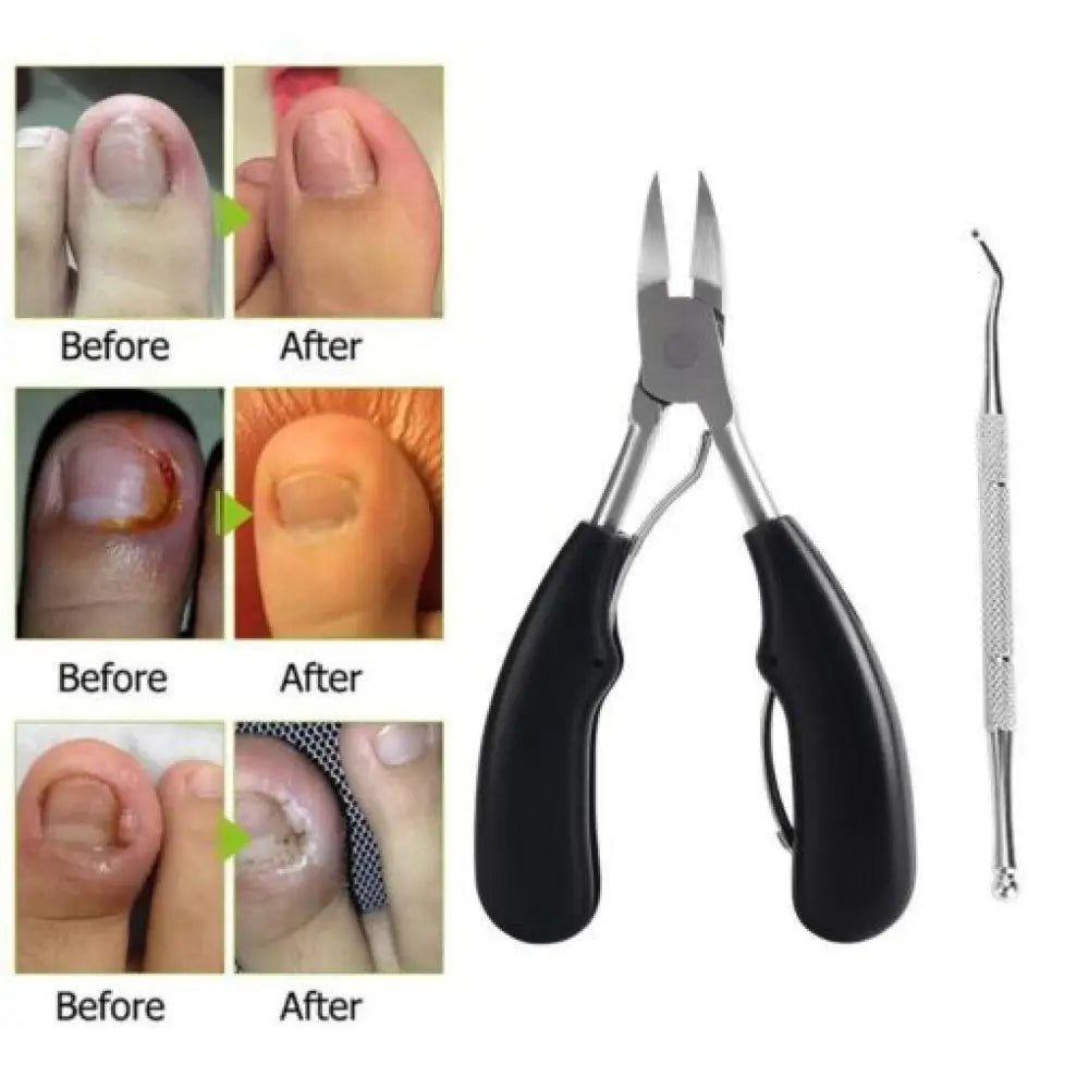 Toe nail Clippers