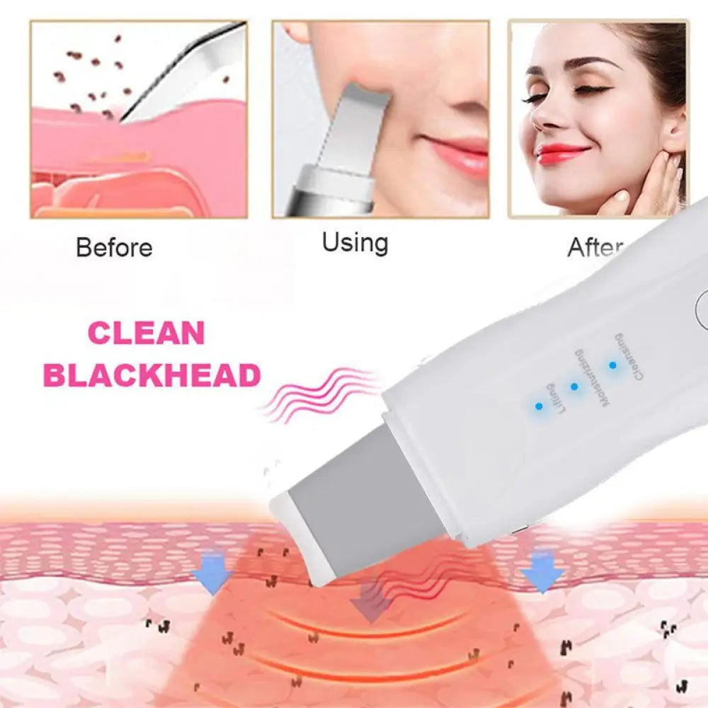 Ultrasonic Skin Scrubber – 3 Modes, Deep Cleanse & Lift