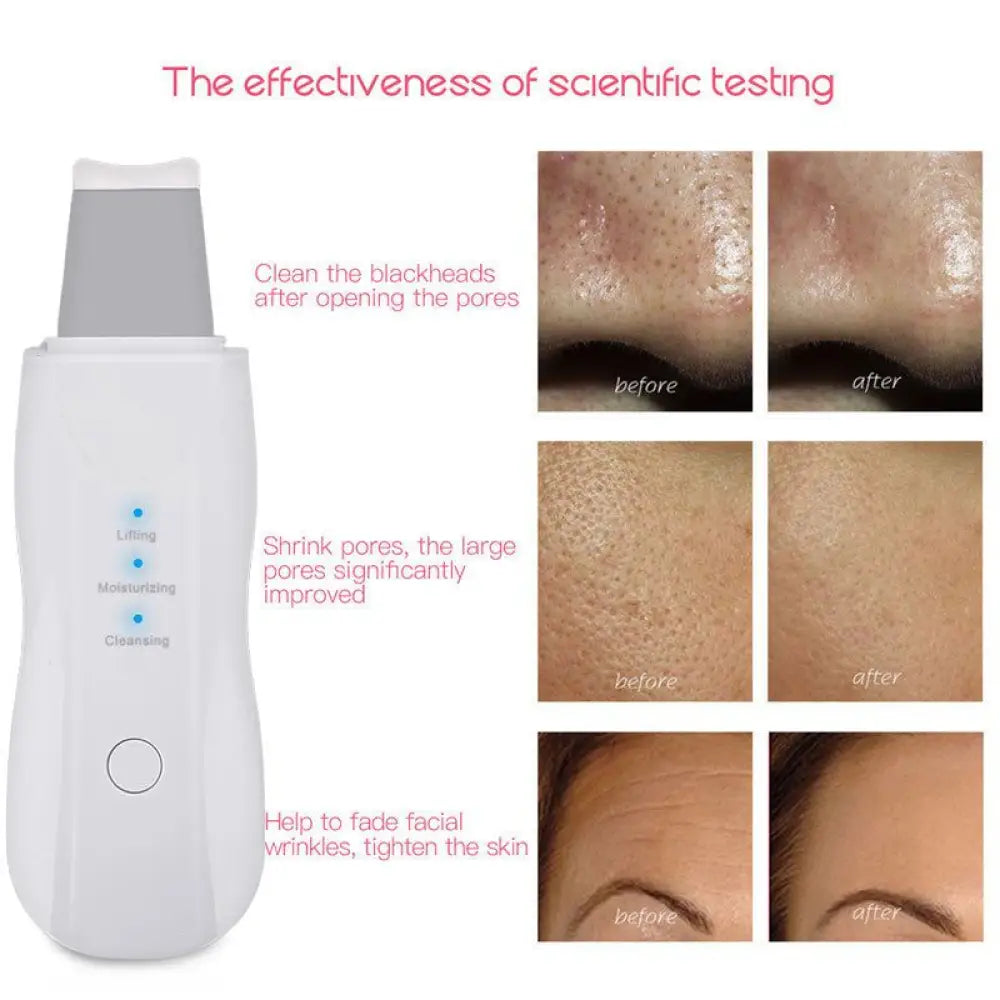 Ultrasonic Skin Scrubber – 3 Modes, Deep Cleanse & Lift