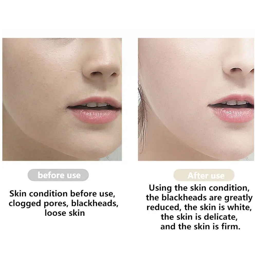 Ultrasonic Skin Scrubber – 3 Modes, Deep Cleanse & Lift