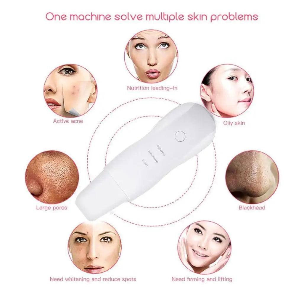 Ultrasonic Skin Scrubber – 3 Modes, Deep Cleanse & Lift