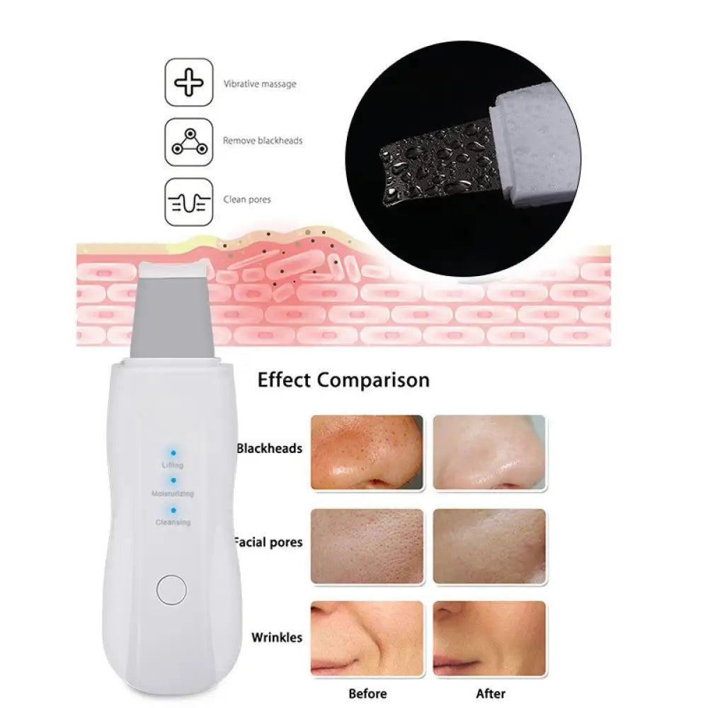 Ultrasonic Skin Scrubber – 3 Modes, Deep Cleanse & Lift