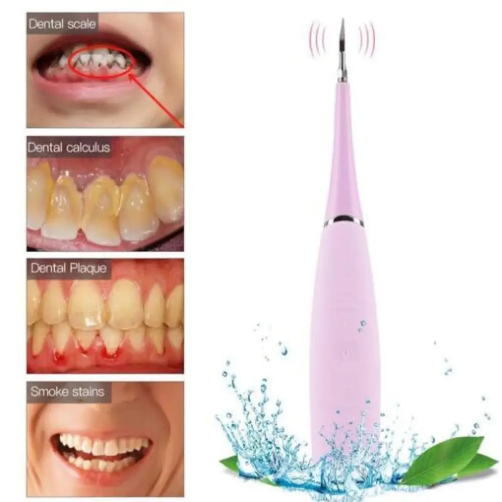 Ultrasonic Tooth Cleaner – 5-Speed, IPX6, Rechargeable