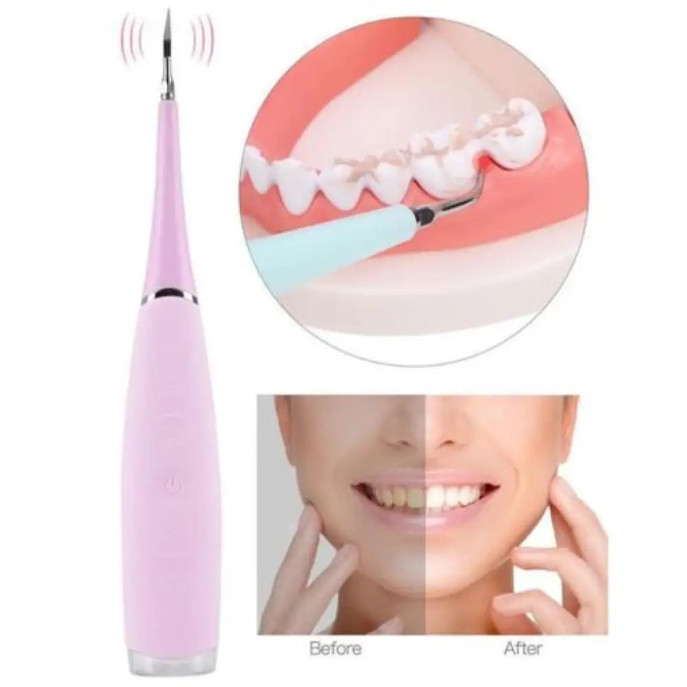 Ultrasonic Tooth Cleaner – 5-Speed, IPX6, Rechargeable