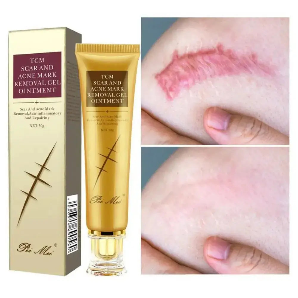 Youthful Scar Remover Cream 2.0 – Natural Scar Treatment 30ml