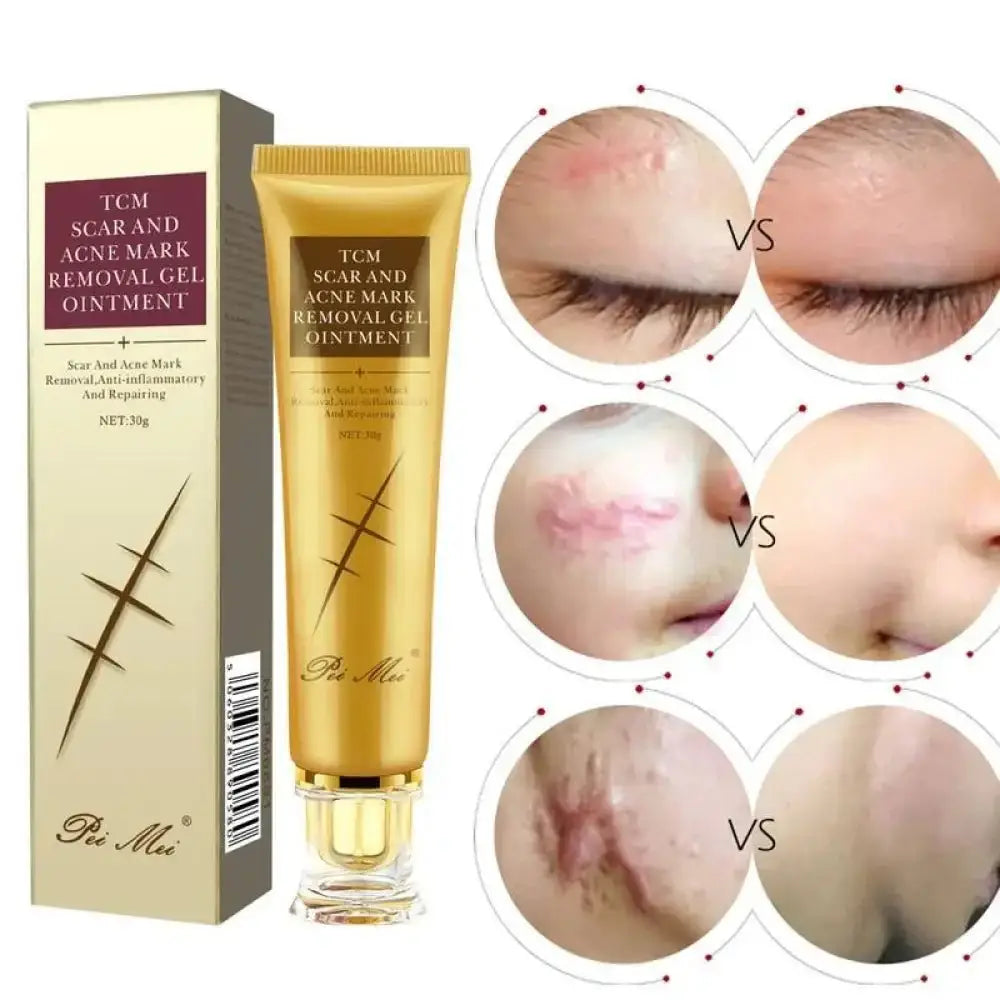Youthful Scar Remover Cream 2.0 – Natural Scar Treatment 30ml